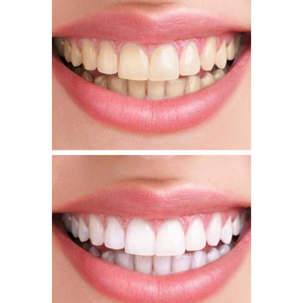 Набор звуковых зубных щеток MEDICA+ PROBRUSH 7.0 black + silver (Japan)